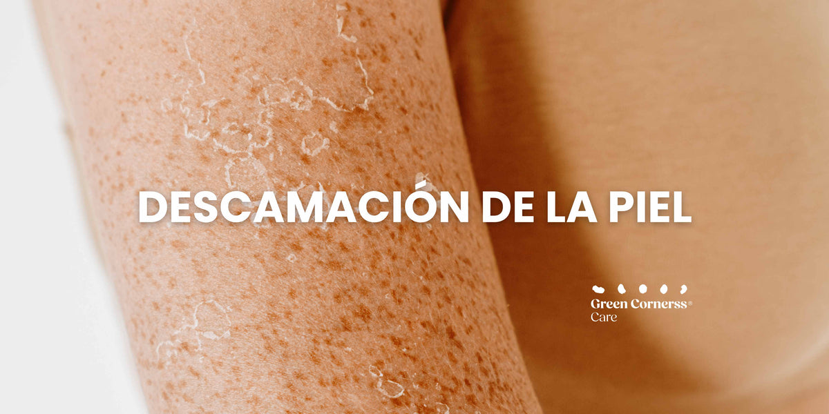 Descamación de la piel: causas, síntomas y tratamiento