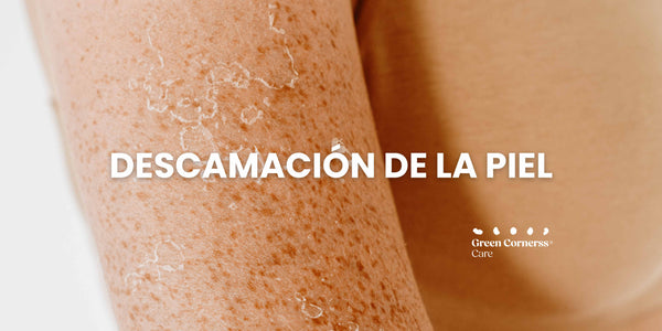 Descamación de la piel: causas, síntomas y tratamiento