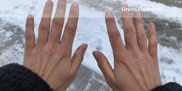 Manos secas y agrietadas en invierno: causas y cómo repararlas