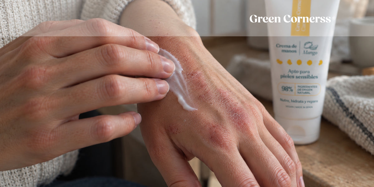 Dermatitis en las manos: causas, síntomas y tratamiento