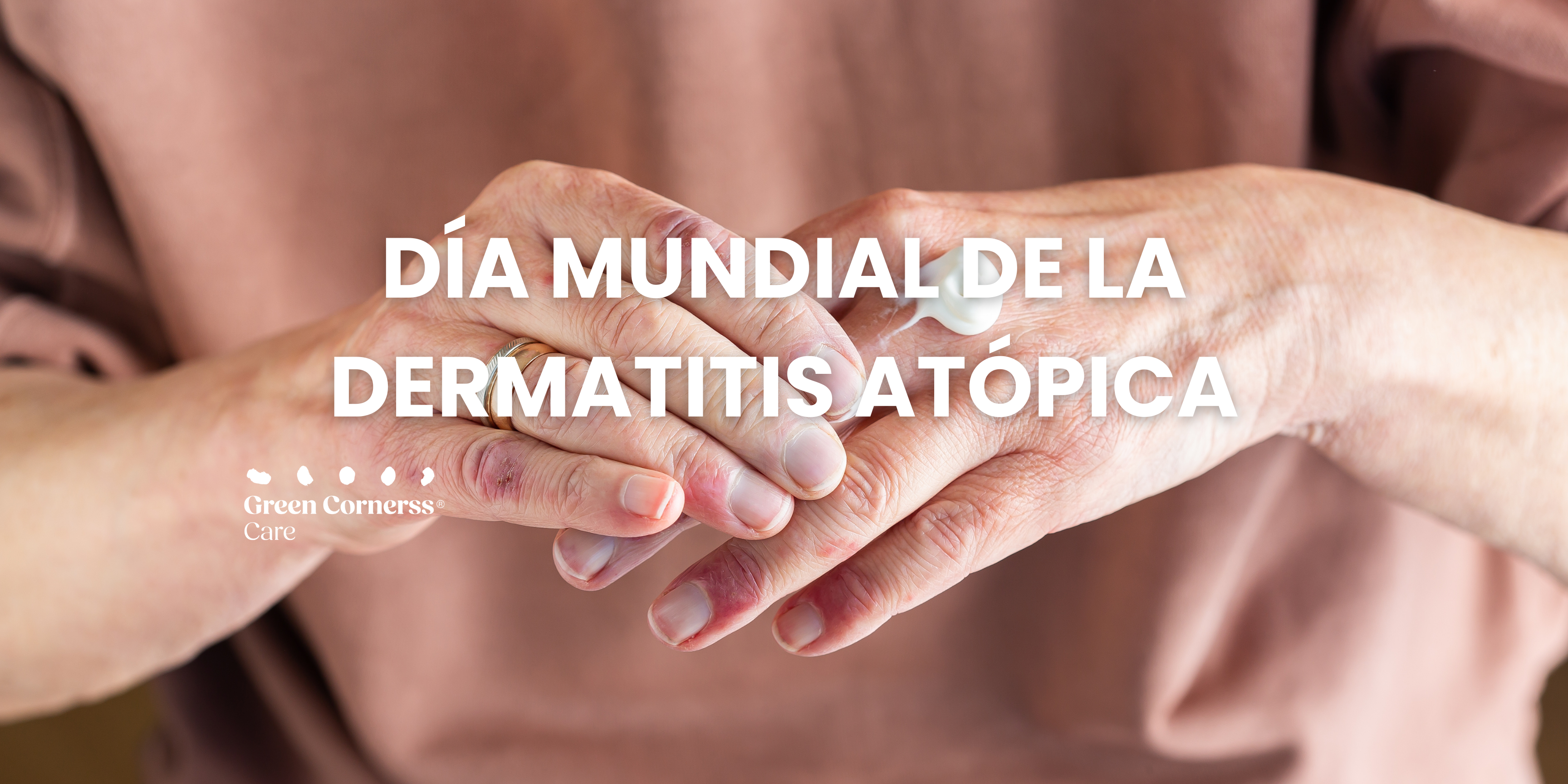 Día Mundial de Dermatitis Atópica