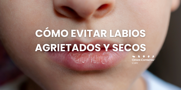 Cómo evitar los labios agrietados y secos con la llegada del frío.