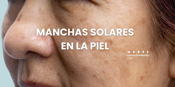 Manchas solares en la piel y como puedes eliminarlas
