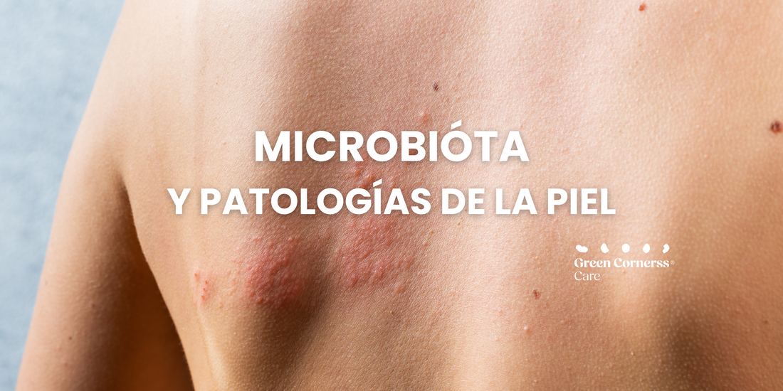 Microbiota y Patologías de la Piel: ¿Cuál es la Relación?
